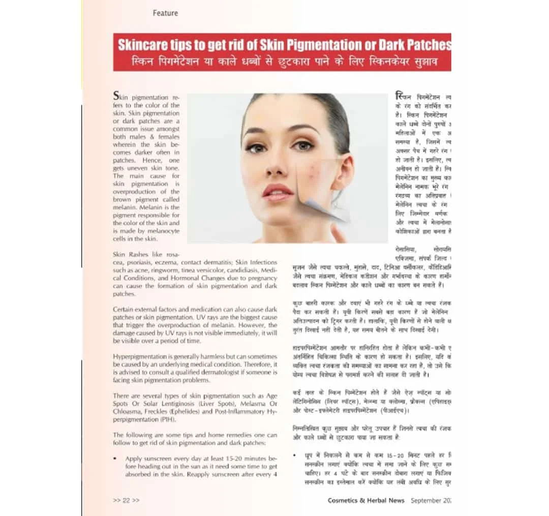 Skincare tips to get rid of skin pigmentation and dark patches