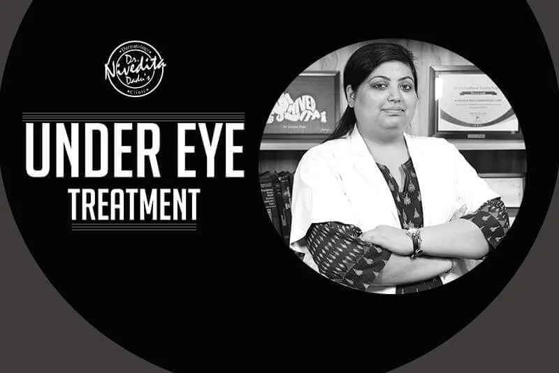 Under Eye Treatment