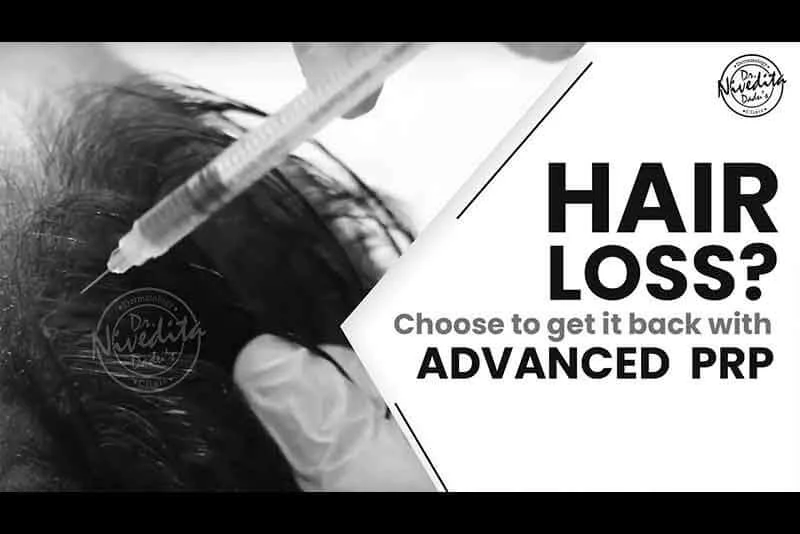 Advanced HGP Treatment | Hair Fall
