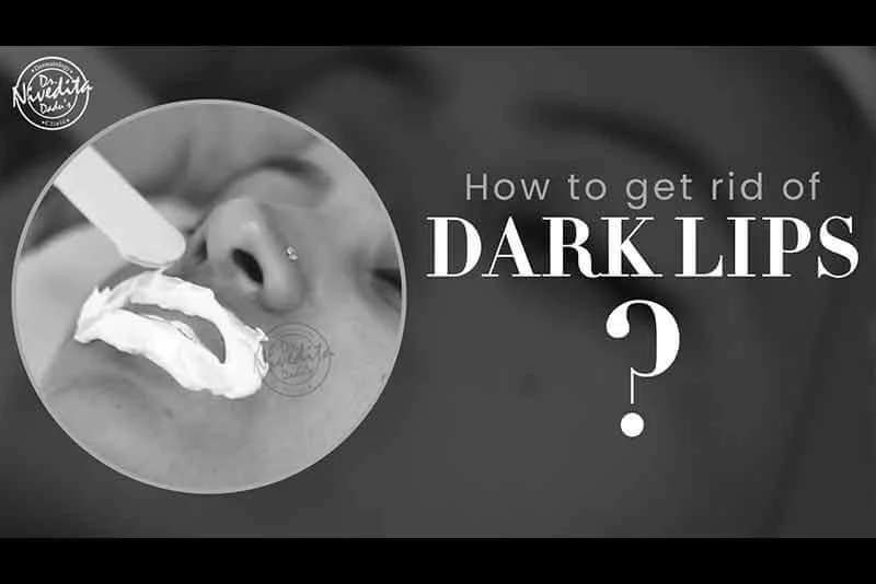 होठो का कालापन दूर करने का रामबाण इलाज | How to Lighten Dark Lips? | Dark Lips Treatment