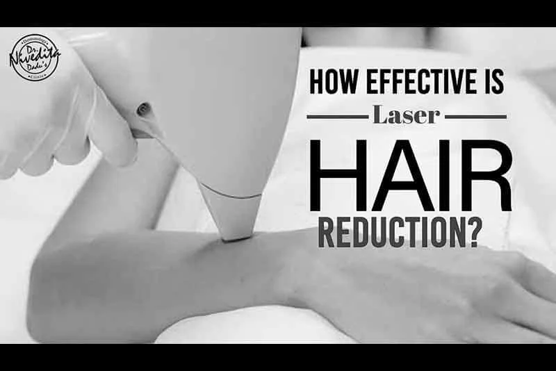 How effective is Laser Hair Reduction?