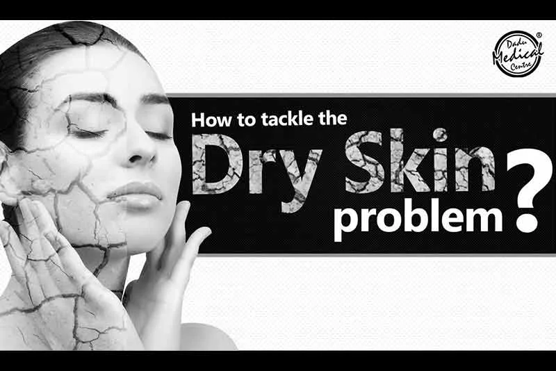 How to Deal with the Dry Skin Problem? | रूखी त्वचा का इलाज | Dr. Nivedita Dadu