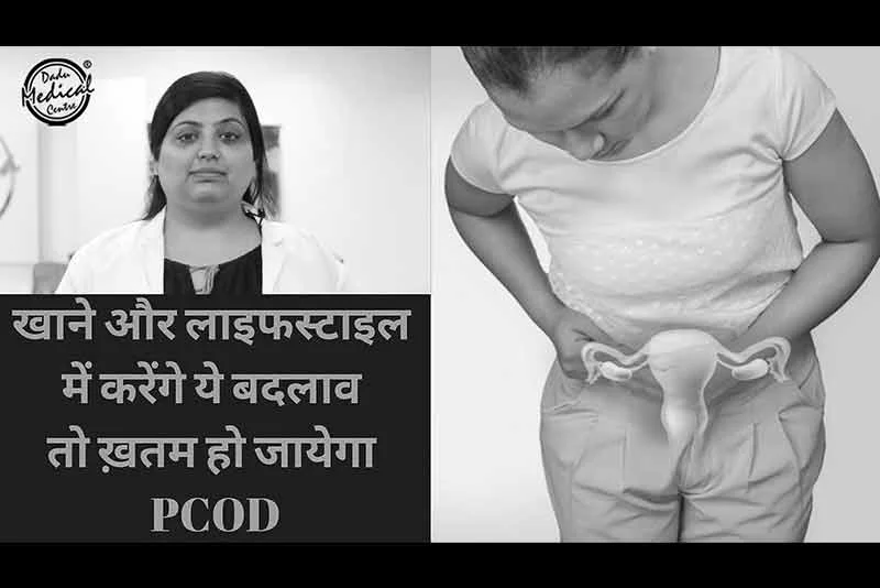 Diet & Lifestyle changes for PCOD and Lean PCOS | PCOD को जड़ से ख़तम करे | Expert Advise (Hindi)