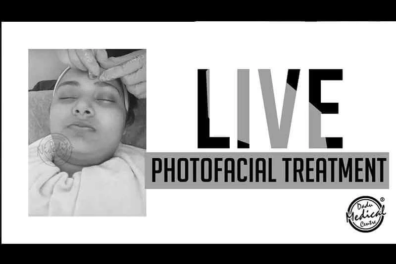 Live Photofacial Treatment - Get the Glow back and make your Skin Rejuvenated