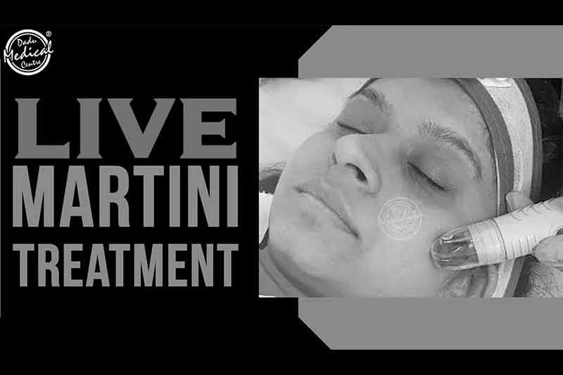 Live Martini Procedure : A complete Solution for all your Skin Problems