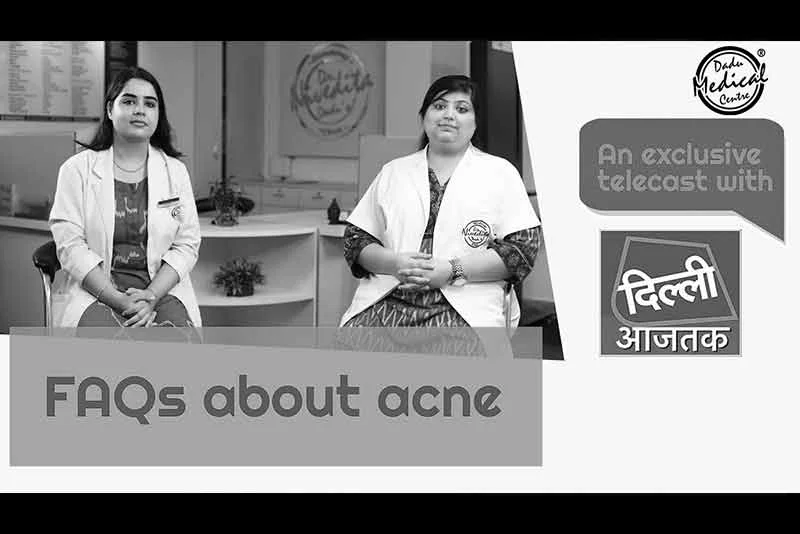 जानिए मुँहासों Acne के बारे में सब कुछ, त्वचा विशेषज्ञ द्वारा- डॉ निवेदिता दादू | Aaj Tak Exclusive