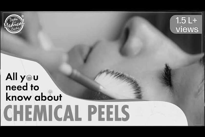 How to Choose the Right Chemical Peels for Your Skin? | Chemical Peel Treatments on Face (In Hindi)