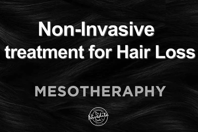 Mesotherapy