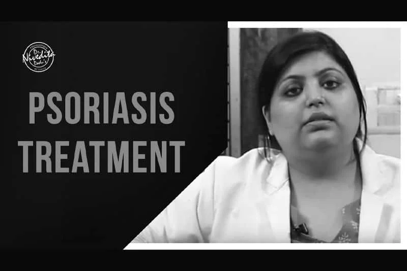 Psoriasis Treatment