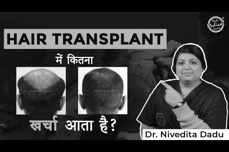 What is the price of hair transplant in India | best hair transplant in Delhi | Dadu Medical Centre