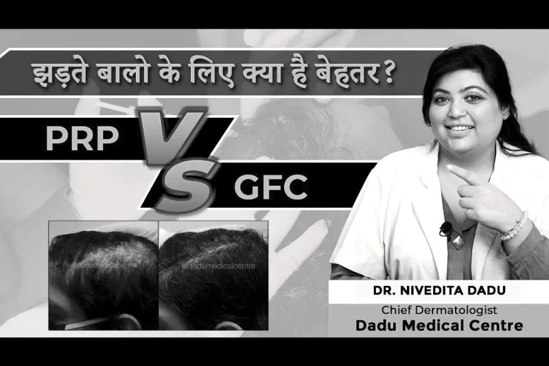 Which technique is better for Hair Fall | GFC VS PRP | Best Treatment for Hair fall | Hair Loss