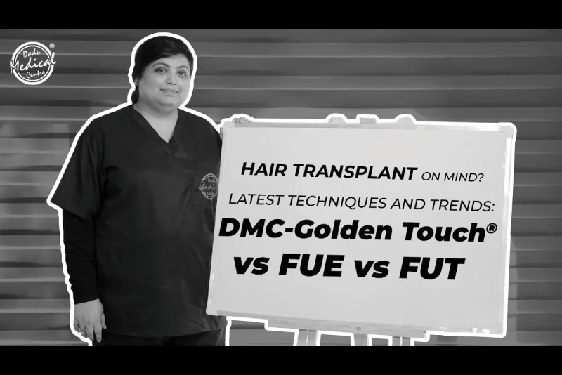 Latest Techniques of Hair Transplant | FUE vs FUT vs DMC-Golden Touch®️ | Hair specialist in Delhi