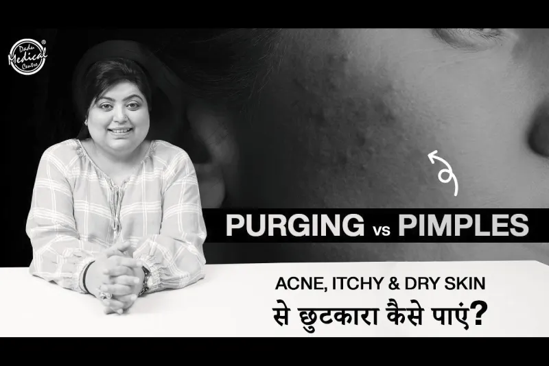Purging vs Pimples: Get rid of Acne, itchy & dry skin
