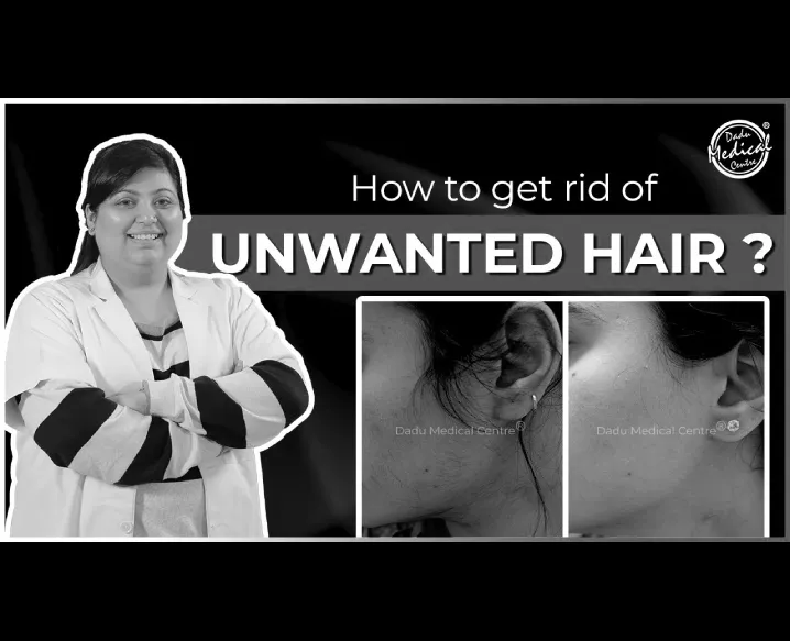 How To Get Rid Of Unwanted Hair? (अनचाहे बालों से छुटकारा कैसे पाएं) | Dr. Nivedita Dadu