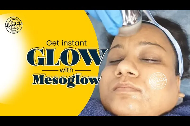 Get Instant Glow With Mesoglow-watch Live