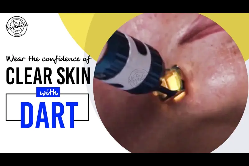 Get Clear Skin with DART | Dr. Nivedita Dadu - Skin Specialist in Delhi