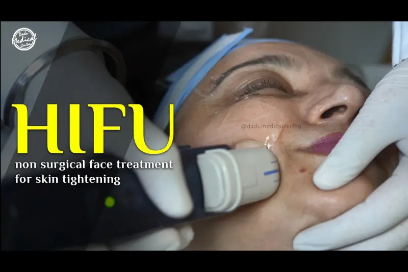 HIFU - High Intensity Focused Ultrasound | Non surgical facelift | Non surgical skin tightening