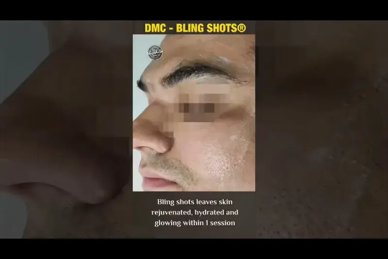 DMC - Bling Shots® | Skin Rejuvenation