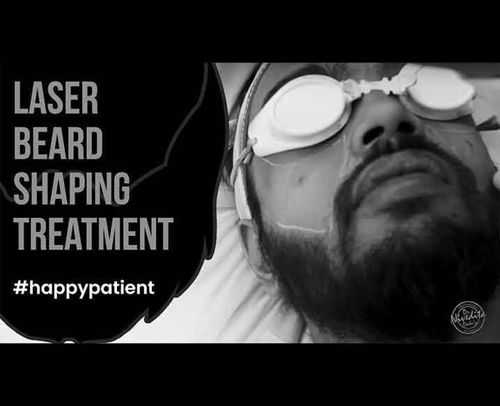 Laser Beard Shaping